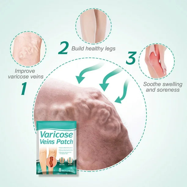 PACK PARCHE VARICES + TOBILLERA COMPRESORA